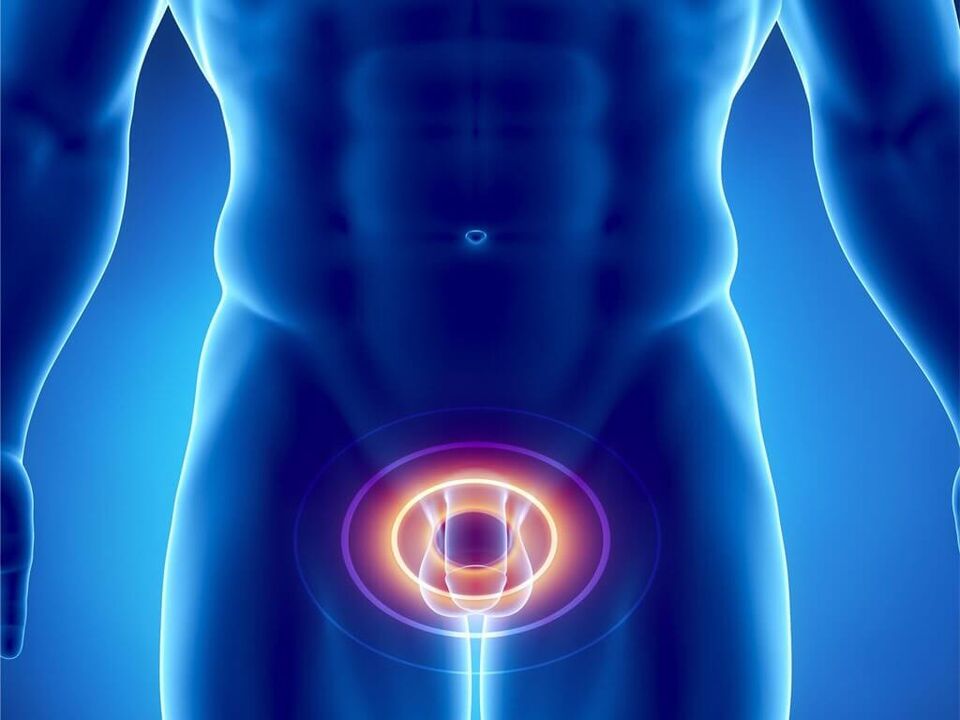 Síntomas de prostatite en homes