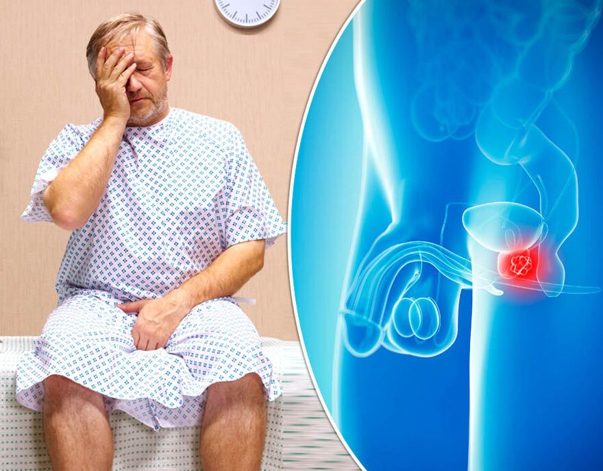 Diagnostícase unha enfermidade nun home con prostatite